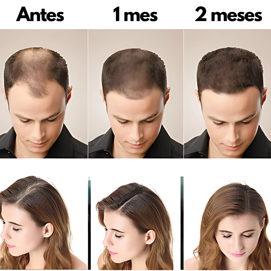 Disaar Anticaída – Recupera tu cabello y frena la caída en 2 semanas