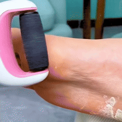 REMOVEDOR DE CALLOS Y EXFOLIANTE DE PIES