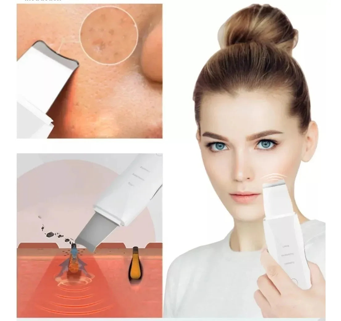 Limpiador Facial Ultrasónico – Limpieza profunda – Piel fresca y suave en minutos