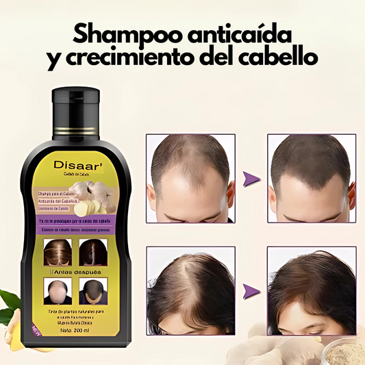 Disaar Anticaída – Recupera tu cabello y frena la caída en 2 semanas